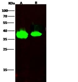 FDPS Rabbit anti-Human, Clone: 2, Novus Biologicals 50 &mu;g; Unconjugated:Antibodies,