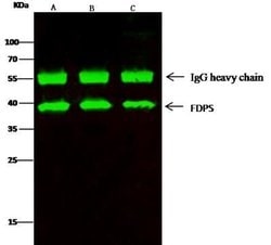 FDPS Rabbit anti-Human, Clone: 5, Novus Biologicals 50 &mu;g; Unconjugated:Antibodies,