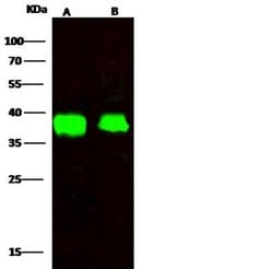 FDPS Rabbit anti-Human, Clone: 5, Novus Biologicals 50 &mu;g; Unconjugated:Antibodies,