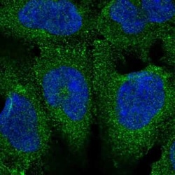 FE65 Antibody, Novus Biologicals:Antibodies:Primary Antibodies