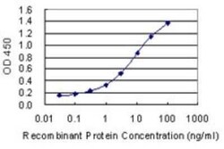 FECH Antibody (3H3), Novus Biologicals 0.1 mg | Buy Online | Novus Biologicals | Fisher Scientific