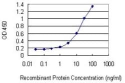 FEM1B Antibody (4B12), Novus Biologicals 0.1 mg | Buy Online | Novus Biologicals | Fisher Scientific
