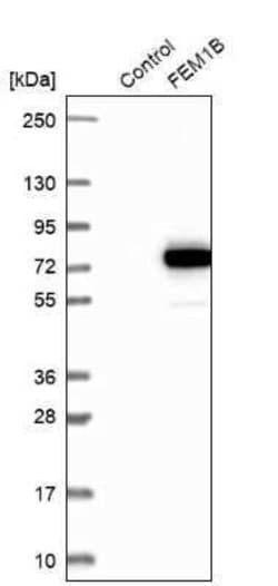 FEM1B Antibody, Novus Biologicals 25 &mu;L | Buy Online | Novus Biologicals | Fisher Scientific