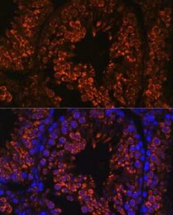 FER1L5 Antibody - Azide and BSA Free, Novus Biologicals:Antibodies:Primary