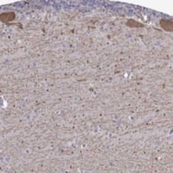 FEZ1 Rabbit anti-Human, Polyclonal, Novus Biologicals 100 &mu;g | Buy Online | Bio-Techne | Fisher Scientific