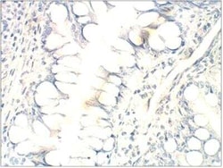 FFAR2/GPR43 Antibody, Novus Biologicals 100 &mu;g | Buy Online | Novus Biologicals | Fisher Scientific