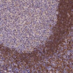 FGD2 Antibody, Novus Biologicals 0.1 mL, Unconjugated:Antibodies, Polyclonal