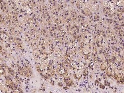 FGD6 Antibody, Novus Biologicals 100 &mu;g, Unconjugated:Antibodies, Polyclonal