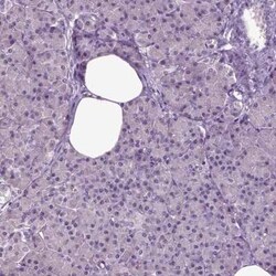 FGF-11 Antibody, Novus Biologicals 25ul; Unconjugated:Antibodies, Polyclonal