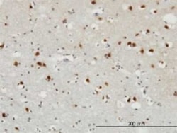 FGF-12 Antibody (1D9), Novus Biologicals 0.1 mg, Unconjugated:Antibodies,
