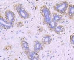 FGF-21 Rabbit anti-Human, Clone: JA10-97, Novus Biologicals 100&mu;L:Antibodies,