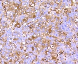 FGF-21 Rabbit anti-Human, Clone: JA10-97, Novus Biologicals 100&mu;L:Antibodies,