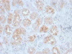 FGF-23 Antibody (FGF23/4163) - Azide and BSA Free, Novus Biologicals 100 &mu;g | Buy Online | Novus Biologicals | Fisher Scientific