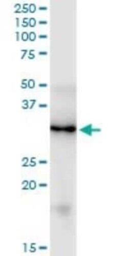 FGF-5 Antibody (1B4), Novus Biologicals 0.1 mg | Buy Online | Novus Biologicals | Fisher Scientific