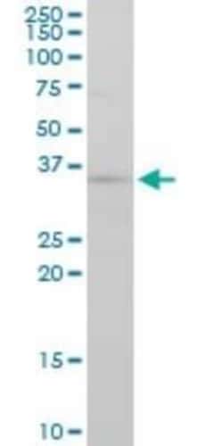 FGF-8 Antibody (2A10), Novus Biologicals 0.1 mg | Buy Online | Novus Biologicals | Fisher Scientific