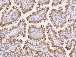 FGF-9 Antibody, Novus Biologicals:Antibodies:Primary Antibodies