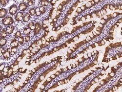 FGF-9 Antibody, Novus Biologicals:Antibodies:Primary Antibodies