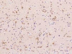 FGF-9 Antibody, Novus Biologicals:Antibodies:Primary Antibodies