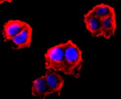 FGFR3 Rabbit anti-Human, Clone: JM81-10, Novus Biologicals 100&mu;L:Antibodies,
