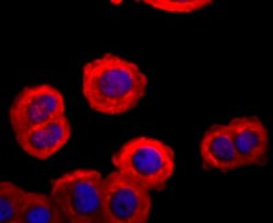 FGFR3 Rabbit anti-Human, Clone: JM81-10, Novus Biologicals 100&mu;L:Antibodies,