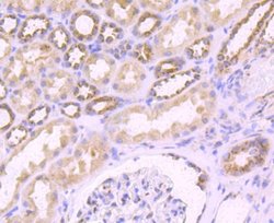 FGFR3 Rabbit anti-Human, Clone: JM81-10, Novus Biologicals 100&mu;L:Antibodies,