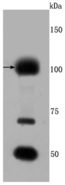 FGFR3 Rabbit anti-Human, Clone: JM81-10, Novus Biologicals 100&mu;L:Antibodies,