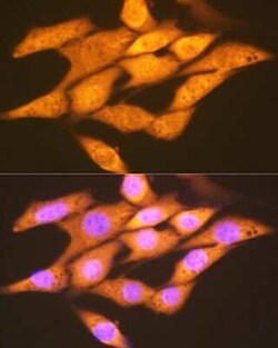 FGF acidic/FGF1 Rabbit anti-Human, Mouse, Rat, Clone: 3X3E5, Novus Biologicals