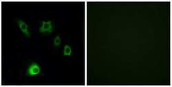 FGF18 Antibody, Novus Biologicals 50 &mu;g; Unconjugated:Antibodies, Polyclonal