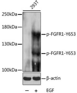 FGFR1, p Tyr653 Antibody - BSA Free, Novus Biologicals 20 &mu;g; Unconjugated:Antibodies,