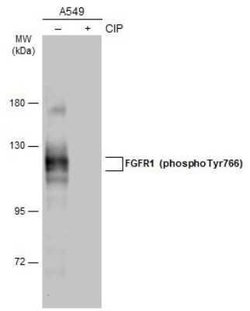 FGFR1, p Tyr766 Antibody, Novus Biologicals 100 &mu;g | Buy Online | Bio-Techne | Fisher Scientific