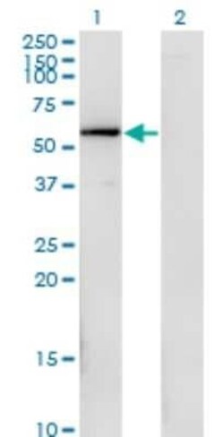 FGFR1OP Antibody (1E8), Novus Biologicals 0.1 mg | Buy Online | Novus Biologicals | Fisher Scientific