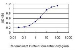 FGFR1OP Antibody (2B1), Novus Biologicals 0.1 mg | Buy Online | Novus Biologicals | Fisher Scientific