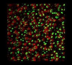 FGFR1OP Antibody (2B1), Novus Biologicals 0.1 mg | Buy Online | Novus Biologicals | Fisher Scientific