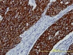 FGFR2 Antibody (1G3), Novus Biologicals 0.1 mg | Buy Online | Novus Biologicals | Fisher Scientific