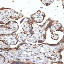FGFR4 Rabbit anti-Human, Mouse, Clone: 2C4E1, Novus Biologicals 100 &mu;g;