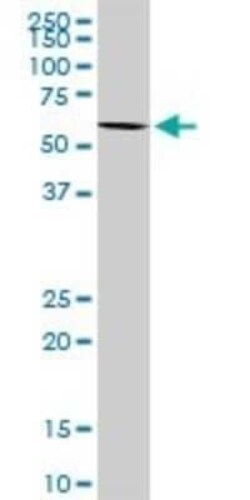 FGGY carbohydrate kinase domain containing Antibody, Novus Biologicals 0.1 mg | Buy Online | Novus Biologicals | Fisher Scientific