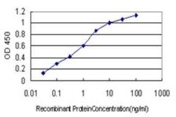 FHIT Antibody (1E3), Novus Biologicals 0.1 mg | Buy Online | Novus Biologicals | Fisher Scientific