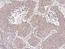 FHIT Antibody, Novus Biologicals:Antibodies:Primary Antibodies