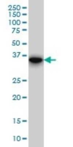 FHL1 Antibody (2A9), Novus Biologicals 0.1 mg | Buy Online | Novus Biologicals | Fisher Scientific