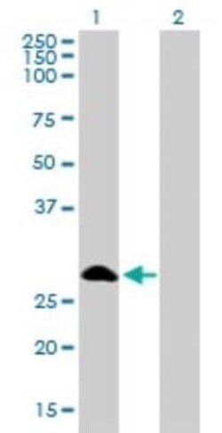 FHL1 Antibody (2A9), Novus Biologicals 0.1 mg | Buy Online | Novus Biologicals | Fisher Scientific