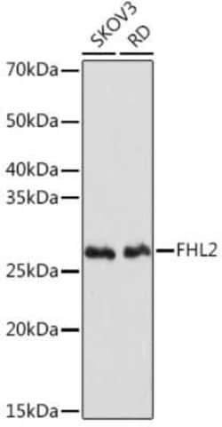 FHL2 Rabbit anti-Human, Mouse, Rat, Clone: 0K9C7, Novus Biologicals 100