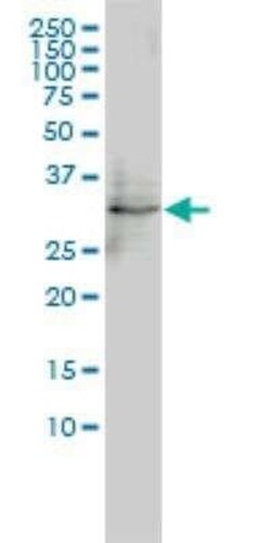 FHL5 Antibody (1G12-D2), Novus Biologicals 0.1 mg | Buy Online | Novus Biologicals | Fisher Scientific