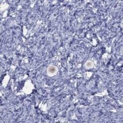 FIGLA Rabbit anti-Human, Polyclonal, Novus Biologicals:Antibodies:Primary