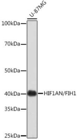 FIH-1/HIF-1AN Rabbit anti-Human, Clone: 9R7V4, Novus Biologicals 20 &mu;g;