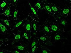 FIH-1/HIF-1AN Antibody, Novus Biologicals 100 &mu;g | Buy Online | Novus Biologicals | Fisher Scientific