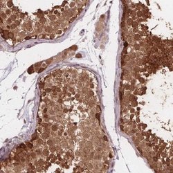 FIH-1/HIF-1AN Antibody, Novus Biologicals:Antibodies:Primary Antibodies