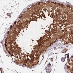 FIH-1/HIF-1AN Antibody, Novus Biologicals:Antibodies:Primary Antibodies