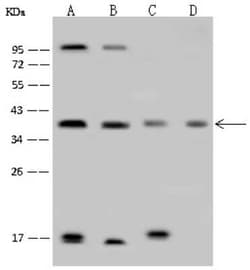 FIH-1/HIF-1AN Antibody, Novus Biologicals 100 &mu;g; Unconjugated:Antibodies,