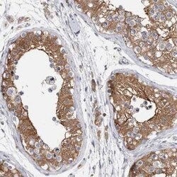 FIP1/RCP Antibody, Novus Biologicals 25 &mu;L | Buy Online | Novus Biologicals | Fisher Scientific