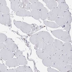 FIP1/RCP Antibody, Novus Biologicals 25 &mu;L | Buy Online | Novus Biologicals | Fisher Scientific
